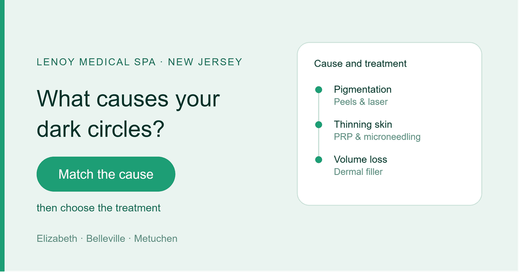 What Is the Most Effective Treatment for Dark Circles Under the Eye?